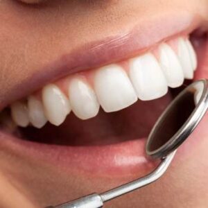 Implantes dentales en Madrid. Recupera la Sonrisa en tan solo un día en Clinica Dental Fernando Soria