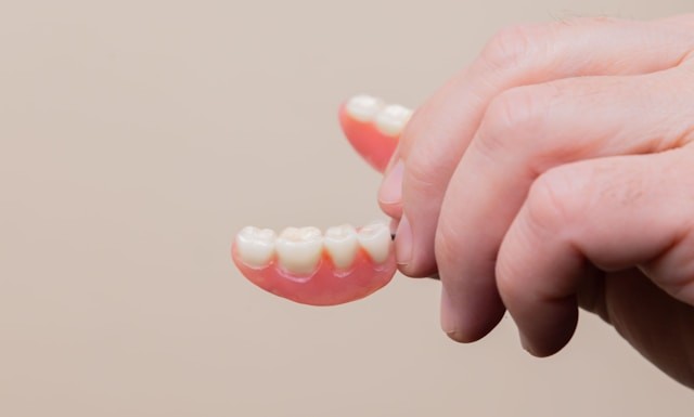 cuanto dura un implante dental