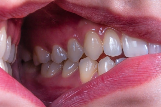 torneras dentales